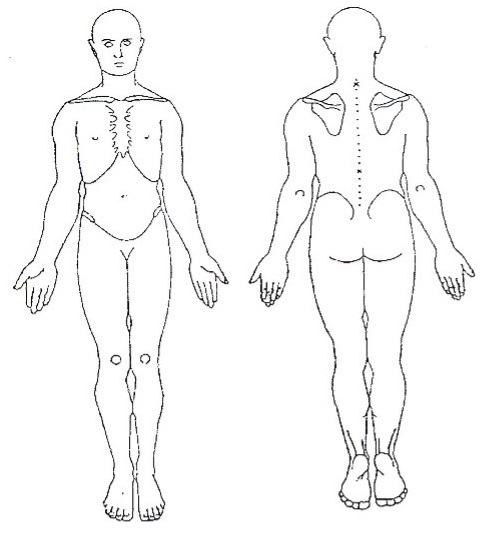 Diagramme corporel - Vues antérieure et postérieure